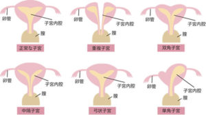 子宮